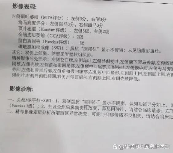 走路老觉得晃是什么问题