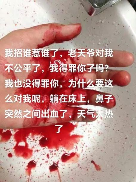玩手机突然流鼻血是怎么了