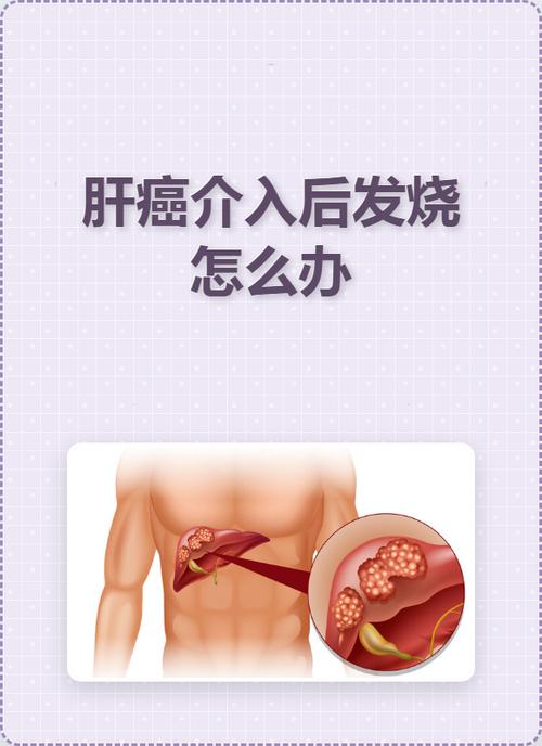 介入后发烧是好还是坏